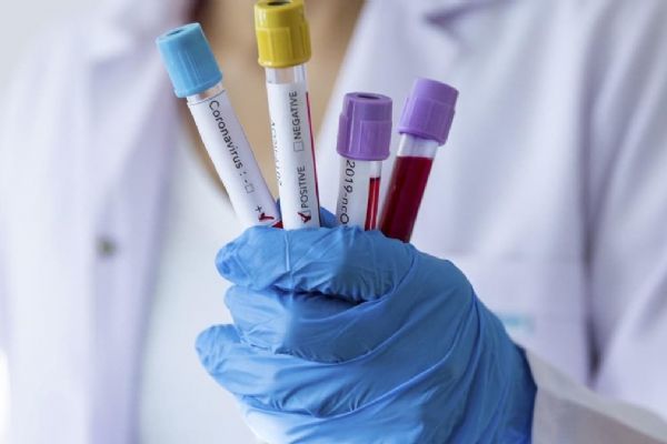 Rusya'da son 24 saatte 8 bin 849 yeni koronavirüs vakası