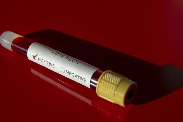 Meksika'da Kovid-19 nedeniyle son 24 saatte 215 kişi öldü