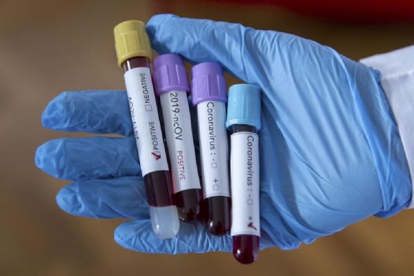 Dünya genelinde tedavisi süren Kovid-19 hasta sayısı 3 milyonu aştı