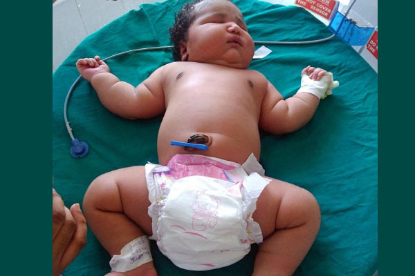 Dünyanın en ağır bebeğini doğdu