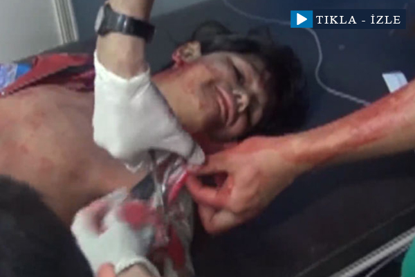 Halepli çocuk: Kesmeyin cici kıyafetlerimi