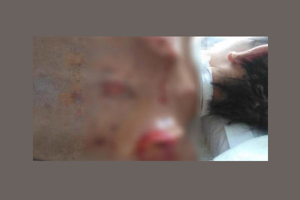 Genç çocuk hastaneden yaralar içinde çıktı