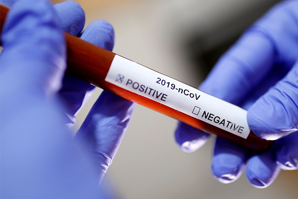 Irak'ta düğün yemeğine katılan onlarca kişi koronavirüse yakalandı