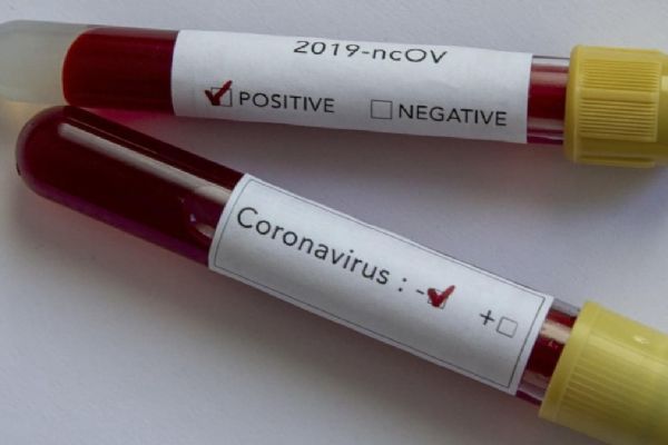 Meksika'da son 24 saatte 354 kişi Kovid-19 nedeniyle hayatını kaybetti