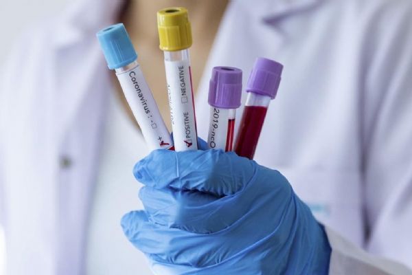 Dünya genelinde Kovid-19 tespit edilen kişi sayısı 7 milyon 200 bini geçti