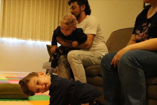 Londra'da operasyonla ayrılan siyam ikizleri Türkiye'ye dönüyor