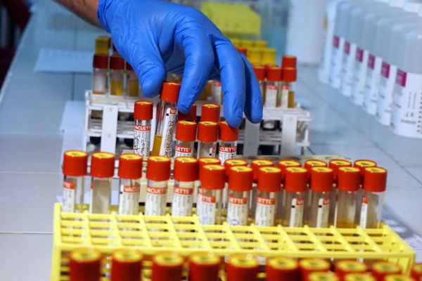 Antikor testleri başladı: 20 Haziran’da sonuçlanacak