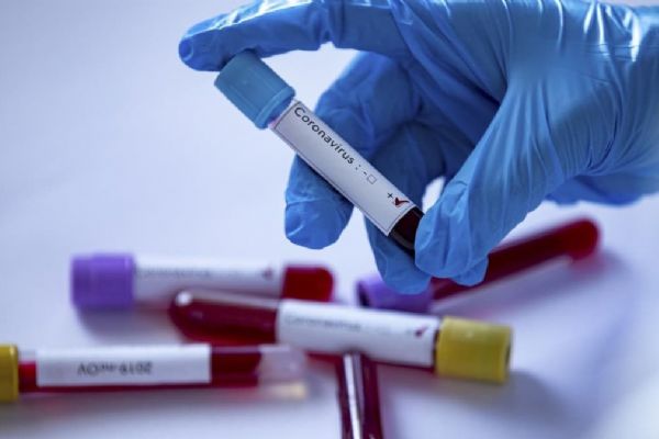 Dünya genelinde Kovid-19 vaka sayısı 8 milyon 120 bini geçti