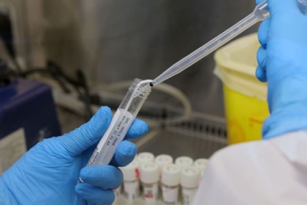 Rusya'da son 24 saatte 8 bin 248 yeni koronavirüs vakası