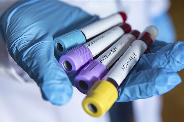 İcra katibinin Kovid-19 testi pozitif çıktı