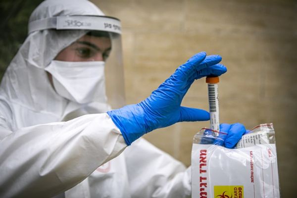 Antikor testinin özelliği nedir?