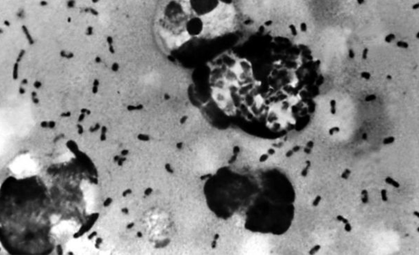 Çin'de koronavirüsten sonra şimdi de 'hıyarcıklı veba' ortaya çıktı