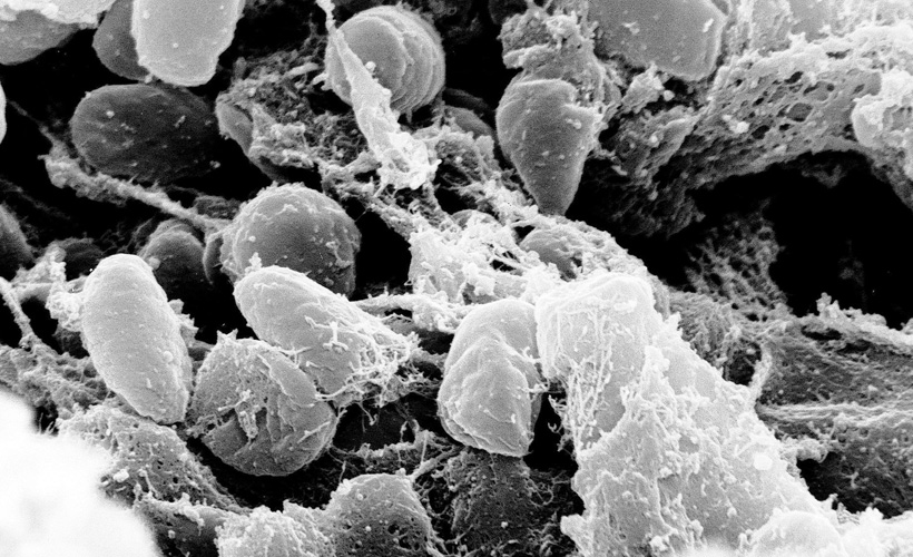 DSÖ'den ''hıyarcıklı veba'' açıklaması