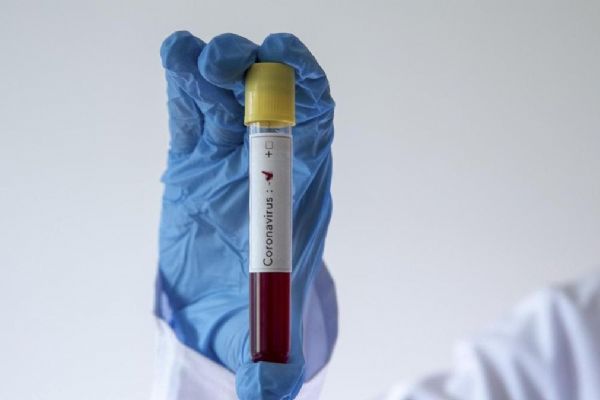 Irak'ta Kovid-19 nedeniyle son 24 saatte 94 kişi öldü