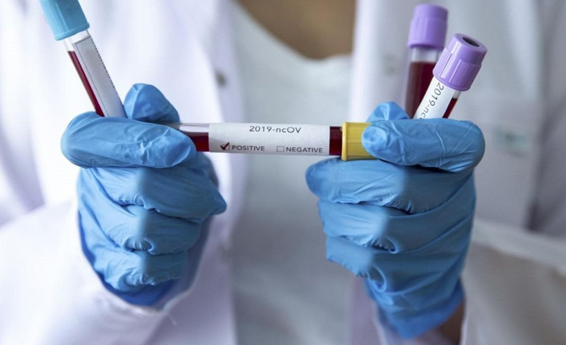 ABD'de Kovid-19 salgınında ölenlerin sayısı 916 artarak 139 bin 189'a yükseldi