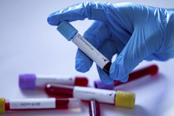 Peru, Kolombiya ve Ekvador'da Kovid-19 bilançosu artıyor