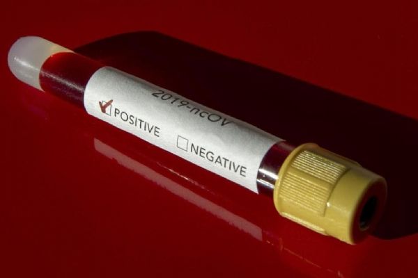 Irak'ta Kovid-19'dan bir günde 94 kişi öldü