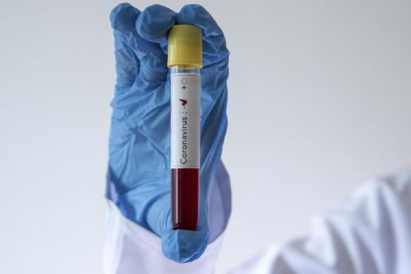 Azerbaycan'da son 24 saatte 471 yeni koronavirüs vakası görüldü