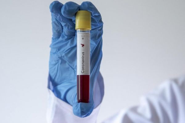 Romanya, Türkiye'yi Kovid-19 ile ilgili riskli ülkeler listesinden çıkardı