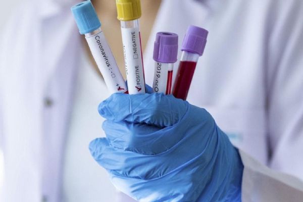 Rusya'da koronavirüs bilançosu artıyor