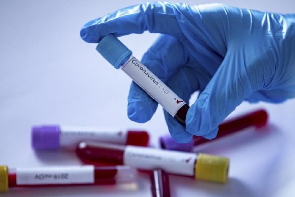 Kuveyt, Umman, BAE ve Filistin'de koronavirüs kaynaklı can kayıpları arttı