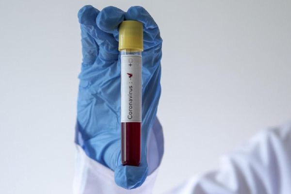 Suudi Arabistan'da Kovid-19 kaynaklı can kaybı 2 bin 816'ya yükseldi