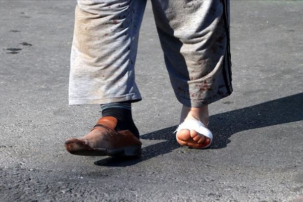 İstanbul'da 1153 kişi, kurban kesmeye çalışırken yaralandı