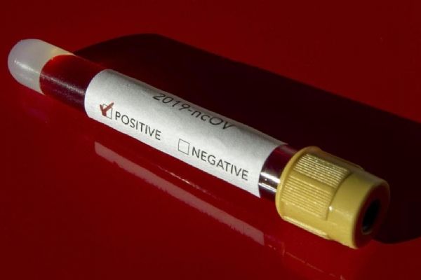 Afrika'da tespit edilen koronavirüs vaka sayısı 980 bini geçti