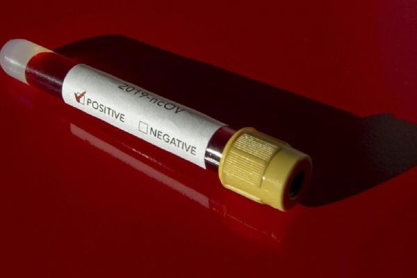 Rusya’da koronavirüs aşısının tescil edileceği tarih belli oldu