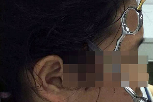 Fırlattığı makas kızının şakağına saplandı