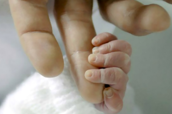 Beyin ölümü gerçekleşen kadın doğum yaptı