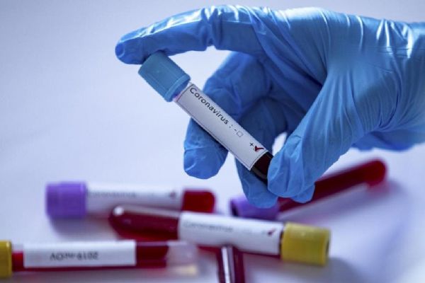 Avustralya'da son 24 saatte Kovid-19 nedeniyle 25 kişi hayatını kaybetti