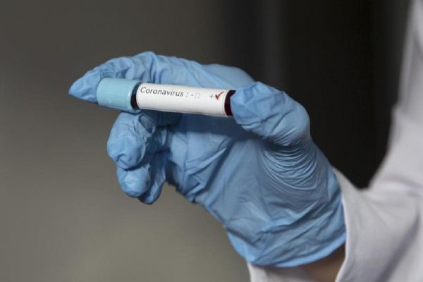 Peru, Kolombiya ve Ekvador'da Kovid-19 kaynaklı can kayıpları artıyor