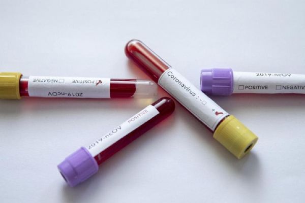 İran'da koronavirüs nedeniyle 153 kişi daha hayatını kaybetti