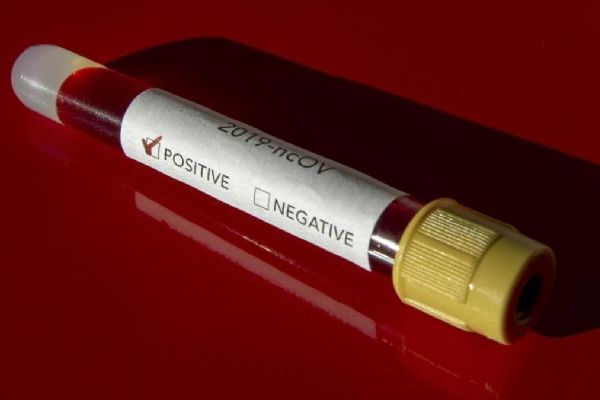 Suudi Arabistan'da Kovid-19'dan 36 can kaybı daha