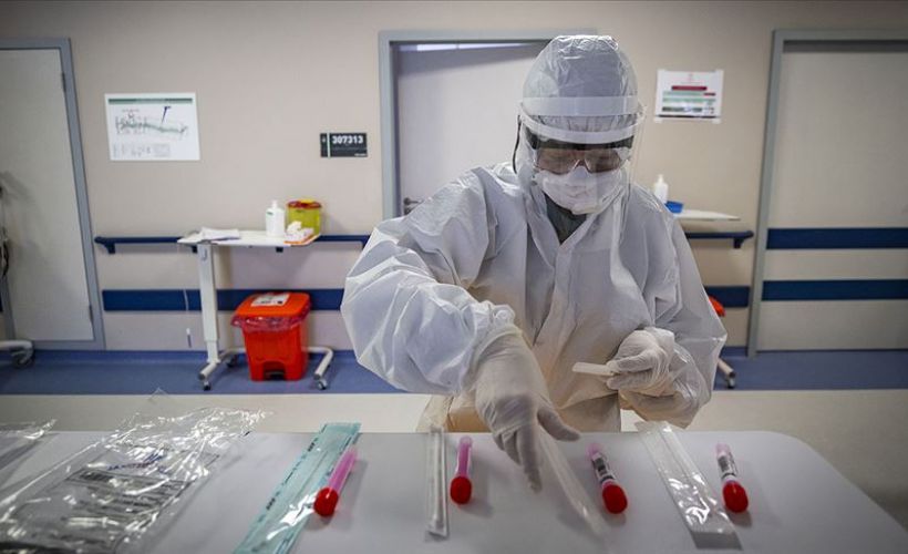 Türkiye’de 1512 kişiye daha Kovid-19 tanısı konuldu