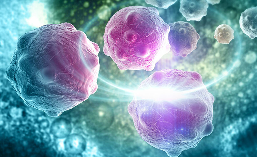 Rus doktora göre, kanseri önlemenin basit yolu