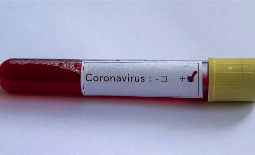 Trump'ın Özel Kalem Müdürü Luna'da Kovid-19 tespit edildi