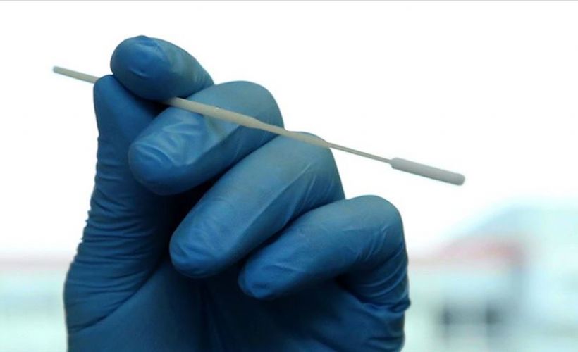 Kovid-19 test sayısı artırılacak
