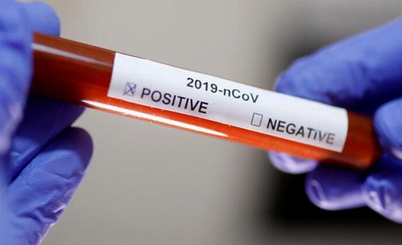 İstanbul’da ürküten Kovid-19 artışı