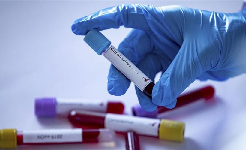 Ürdün'de vaka sayısında en yüksek artış kaydedildi