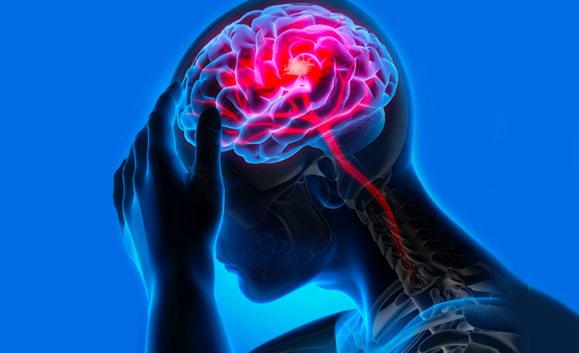 İnmeyi önlemenin 5 ulaşılabilir adımı