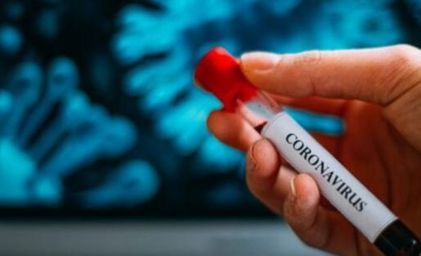 Bugün kaç kişi korona oldu? 7 Aralık korona tablosu