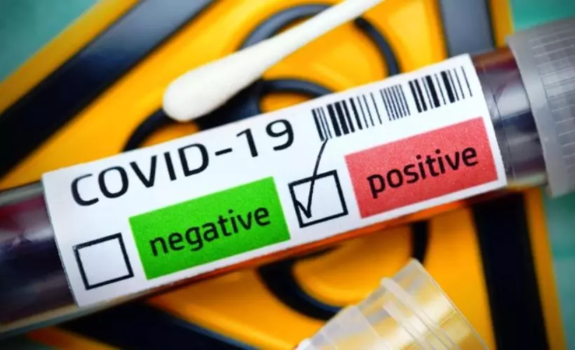 Korona test ücreti ne kadar? Özel hastane Covid test ücreti kaç para?