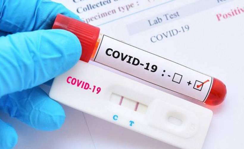 ABD'de hızlı test kiti skandalı