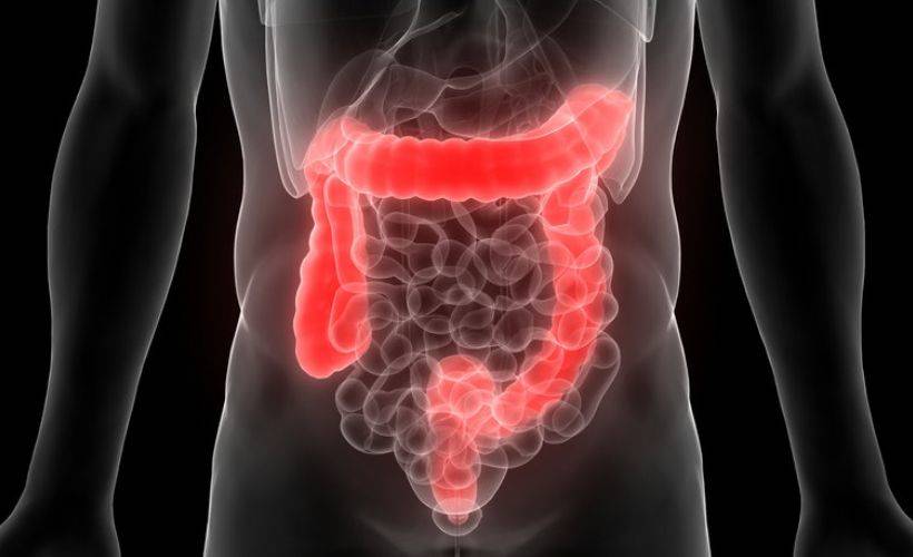 Geçirgen bağırsak sendromu nedir? Irritabl bağırsak sendromu olanlar nasıl beslenmeli?