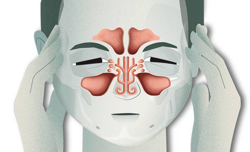 'Sinüzit göz ardı edilirse beyin apnesine neden olabilir'