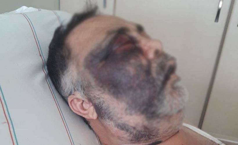 Baba ve oğlu tarafından darbedildiği öne sürülen engelli öldü