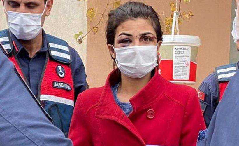 Melek İpek konuştu: Utanmadan, korkmadan yaşadıklarımı anlatmak istiyorum