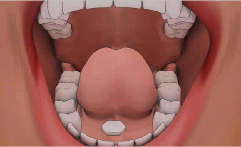 Dilaltı hapı orucu bozar mı? Kalp hastalarının kullandığı dilaltı oruca etki eder mi?